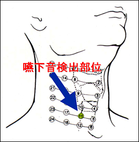 コラム第6回 嚥下障害の検査法1―頸部聴診法（その1）