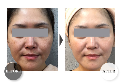 RESTORATION PACK｜MONNALI - 株式会社モナリ