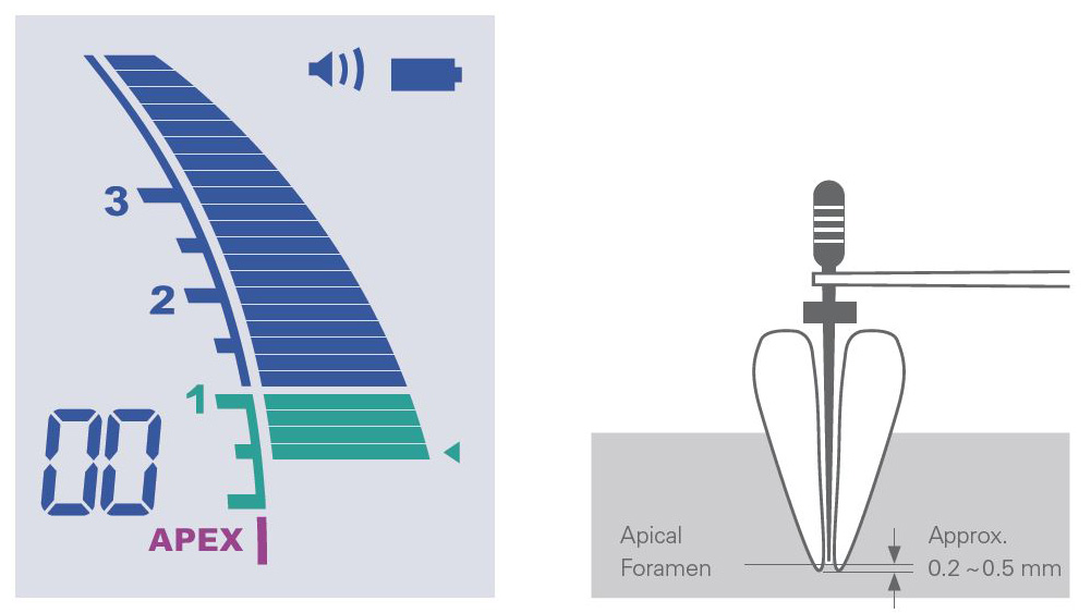 Root ZX mini | MORITA