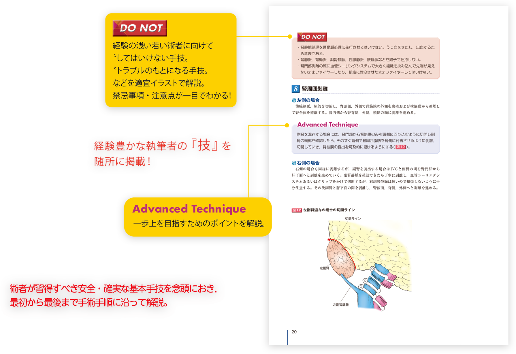 メジカルビュー社 | Urologic Surgery Next