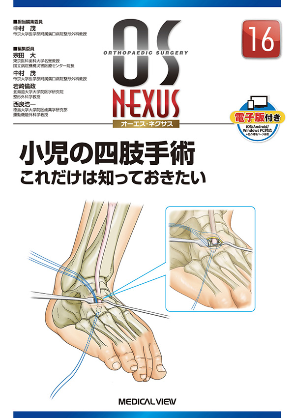 メジカルビュー社｜整形外科｜OS NEXUS 16 小児の四肢手術 これだけは