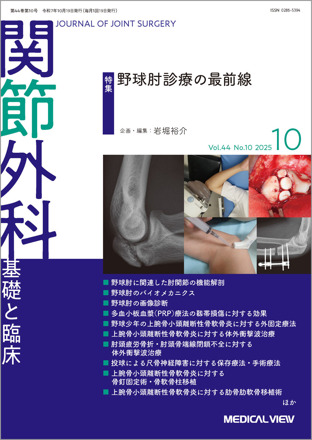 メジカルビュー社｜関節外科特集一覧｜関節外科 2025年10月号