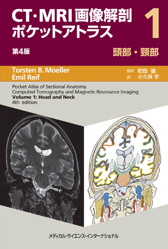 MEDSi)株式会社 メディカル・サイエンス・インターナショナル / CT