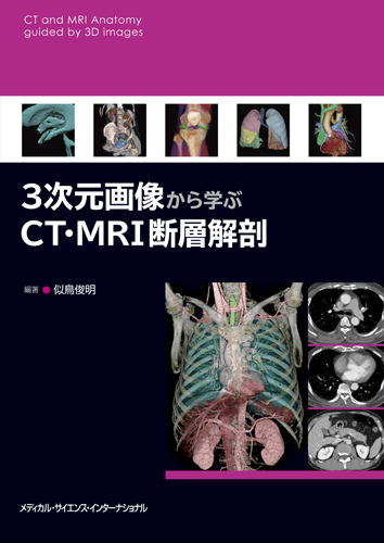 MEDSi)株式会社 メディカル・サイエンス・インターナショナル / 3次元