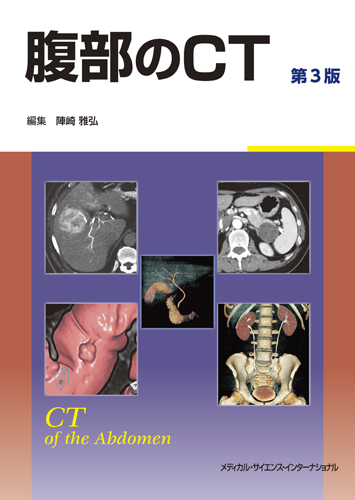 MEDSi)株式会社 メディカル・サイエンス・インターナショナル / NYSORA