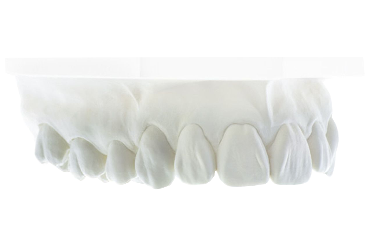 セラミスト向け超硬石膏 | シェーラ ピュア | 名南歯科貿易株式会社