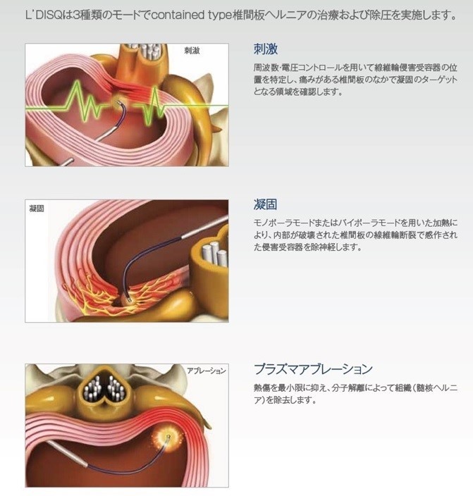 痛みの治療とニューロモデュレーションセンター | 牧田