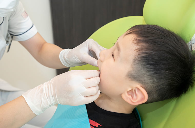 小児歯科・小児予防 | 南森町駅直結の歯医者 | 大阪市北区の南森町