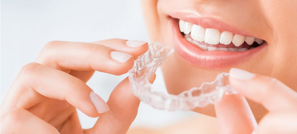 目立たない・取り外せるマウスピース矯正（インビザライン）｜三鷹miki