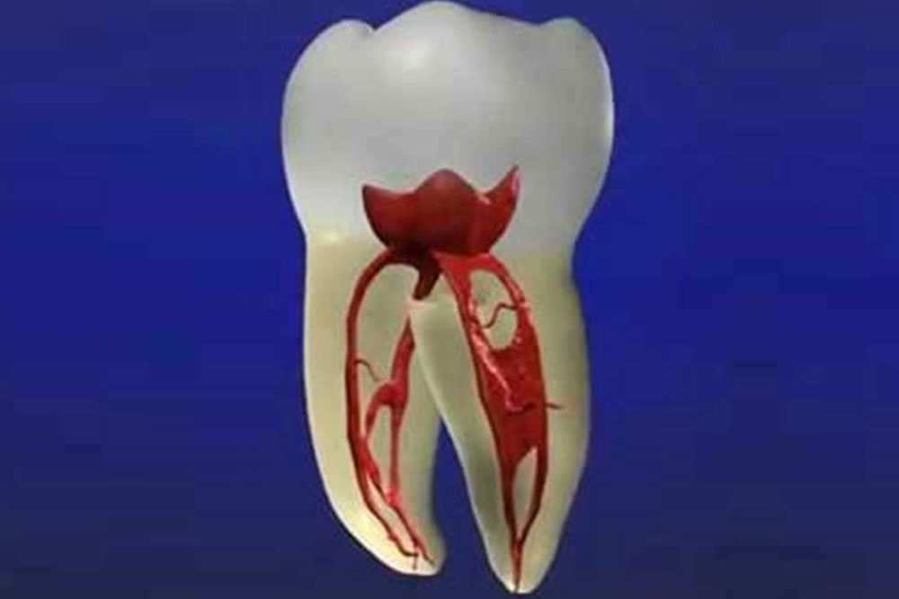 歯を抜かない・取り外しができる床矯正｜三鷹miki矯正歯科
