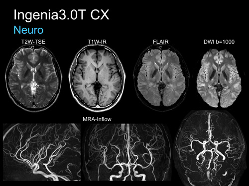 MRI・CT 画像センター | 医療法人みたけ会 きたもと脳神経外科