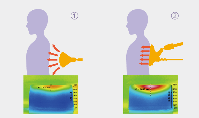 MICROTIZER [MT-5]｜Products｜ミナト医科学株式会社