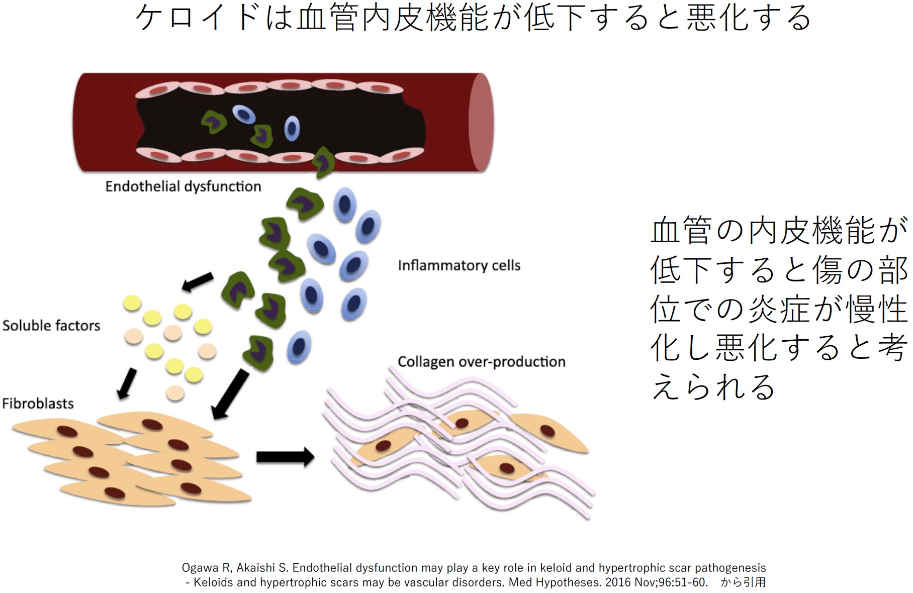 瘢痕・ケロイド研究室｜日本医科大学形成外科学教室