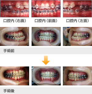 保険診療】顎変形症治療 | 診療科・部門 | 済生会横浜市南部病院
