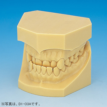 1色レジン製不正咬合顎模型 [D1-O各種](咬合器なし)｜株式会社ニッシン