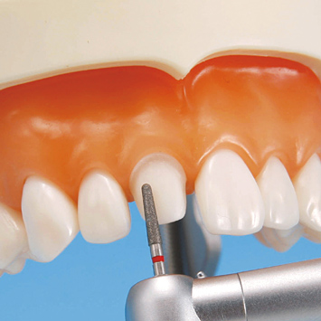 補綴修復実習用顎模型 [D18FE-500A-QF](FE咬合器つき)｜株式会社