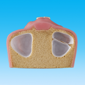 サイナスリフト実習用顎模型 [P9-X.1124]｜株式会社ニッシン｜歯科模型