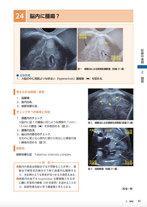 所見から探る 産科 超音波診断｜株式会社総合医学社