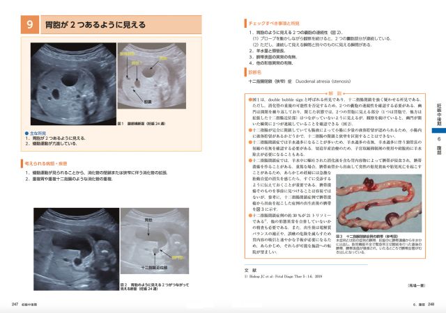 所見から探る 産科 超音波診断｜株式会社総合医学社