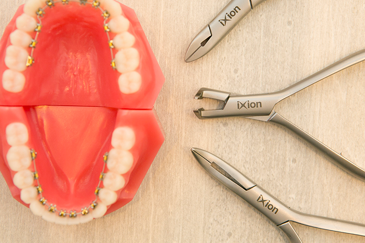 一般的な治療の流れ - ソフィア矯正歯科クリニック