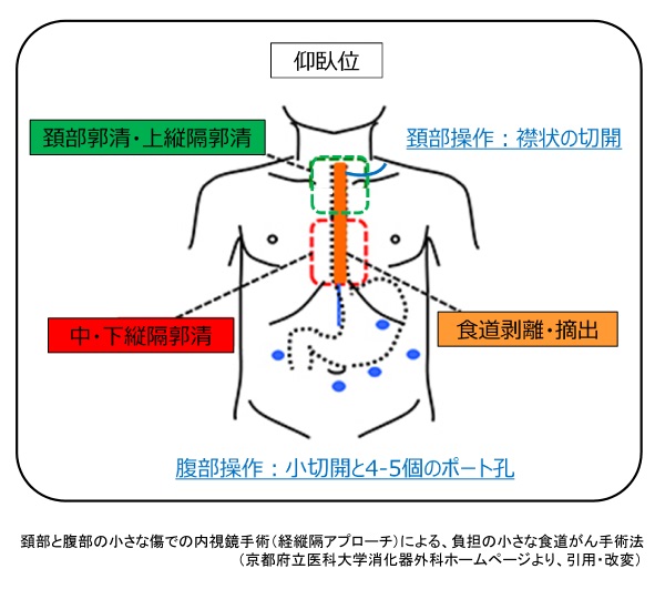上部消化管疾患｜社会福祉法人恩賜財団 済生会滋賀県病院