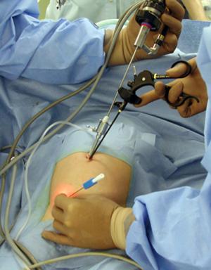 小児外科 - 埼玉県立小児医療センター