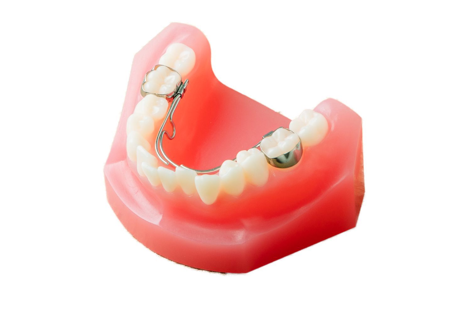 大阪堺で実績の小児矯正！6歳からはじめて美しい歯並びを！難症例実績