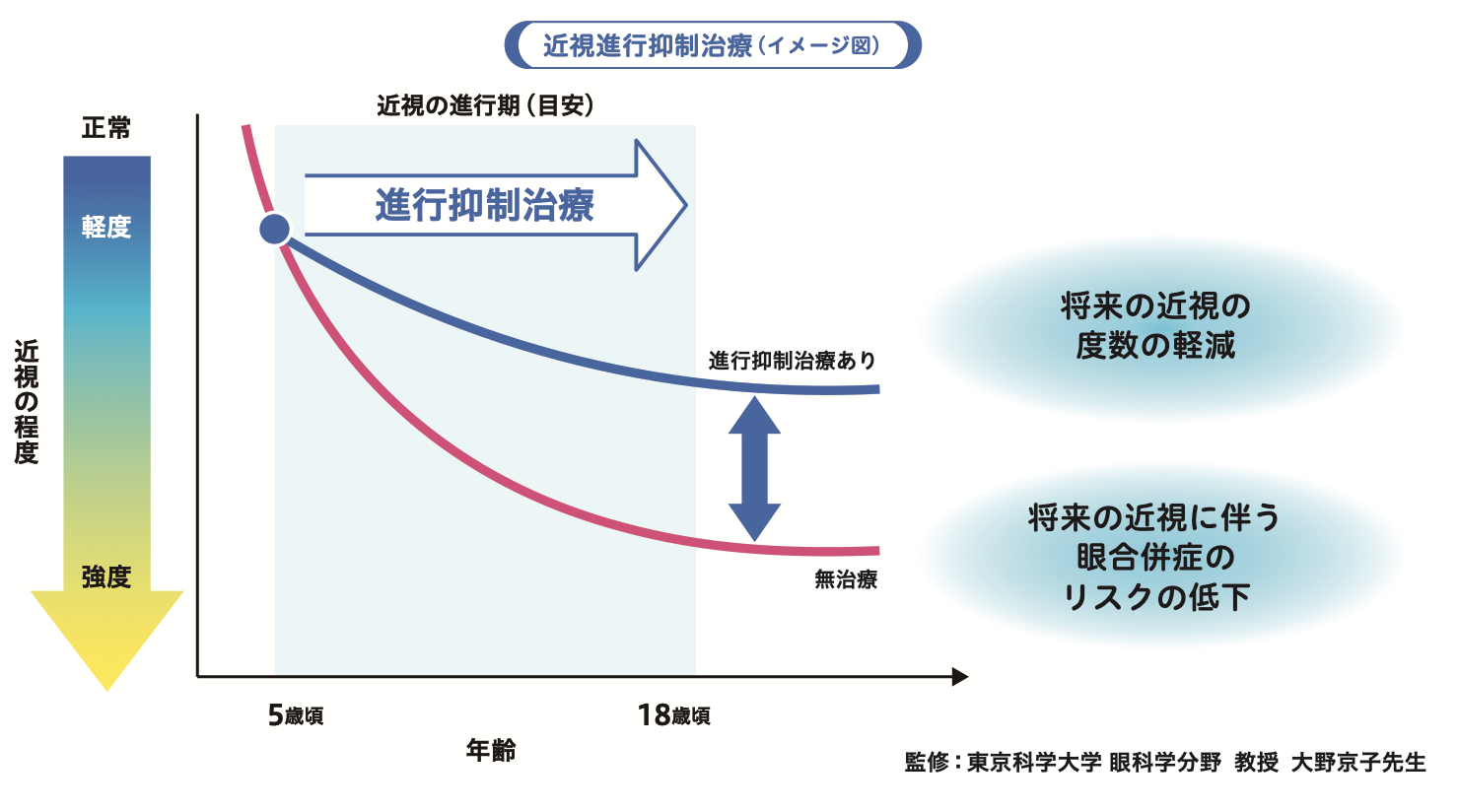 低濃度アトロピン点眼薬｜川崎市中原区-さこう眼科-小児眼科（近視