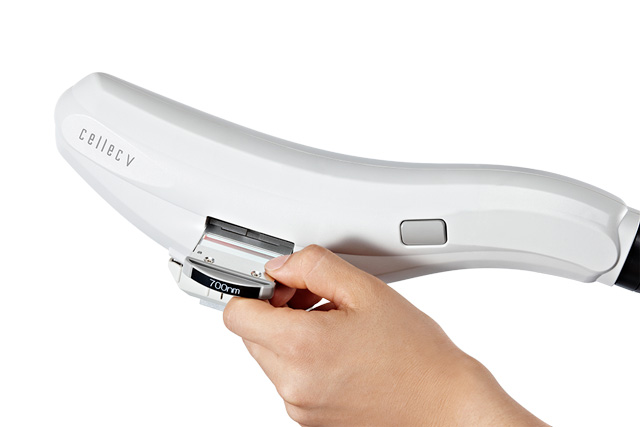 フォト・フェイシャル（IPL光美肌治療)『cellec V(セレック ブイ