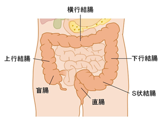 腹腔鏡下大腸（結腸・直腸）切除術 | 医療法人社団 誠馨会 新東京病院