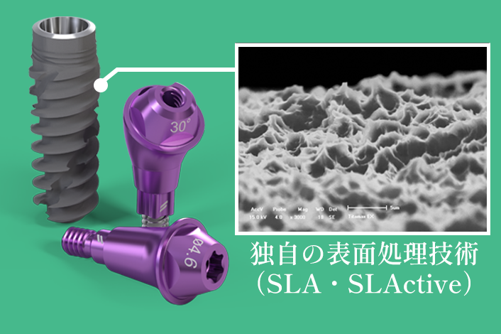 ストローマンインプラント 世界シェアNo.1の安心インプラント｜品川