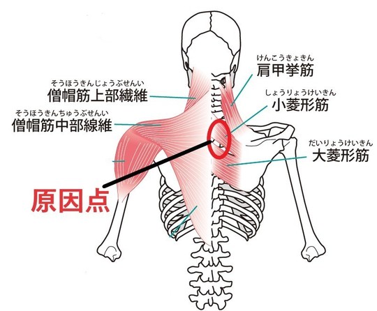 頚椎症 - 名古屋市緑区の鍼灸院 鍼灸TAKA【初めても安心】
