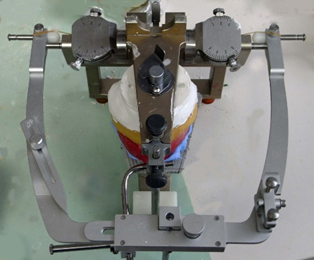 シーラシステムとは | 大手町 歯科｜大手町駅直結の歯医者 松翁会歯科