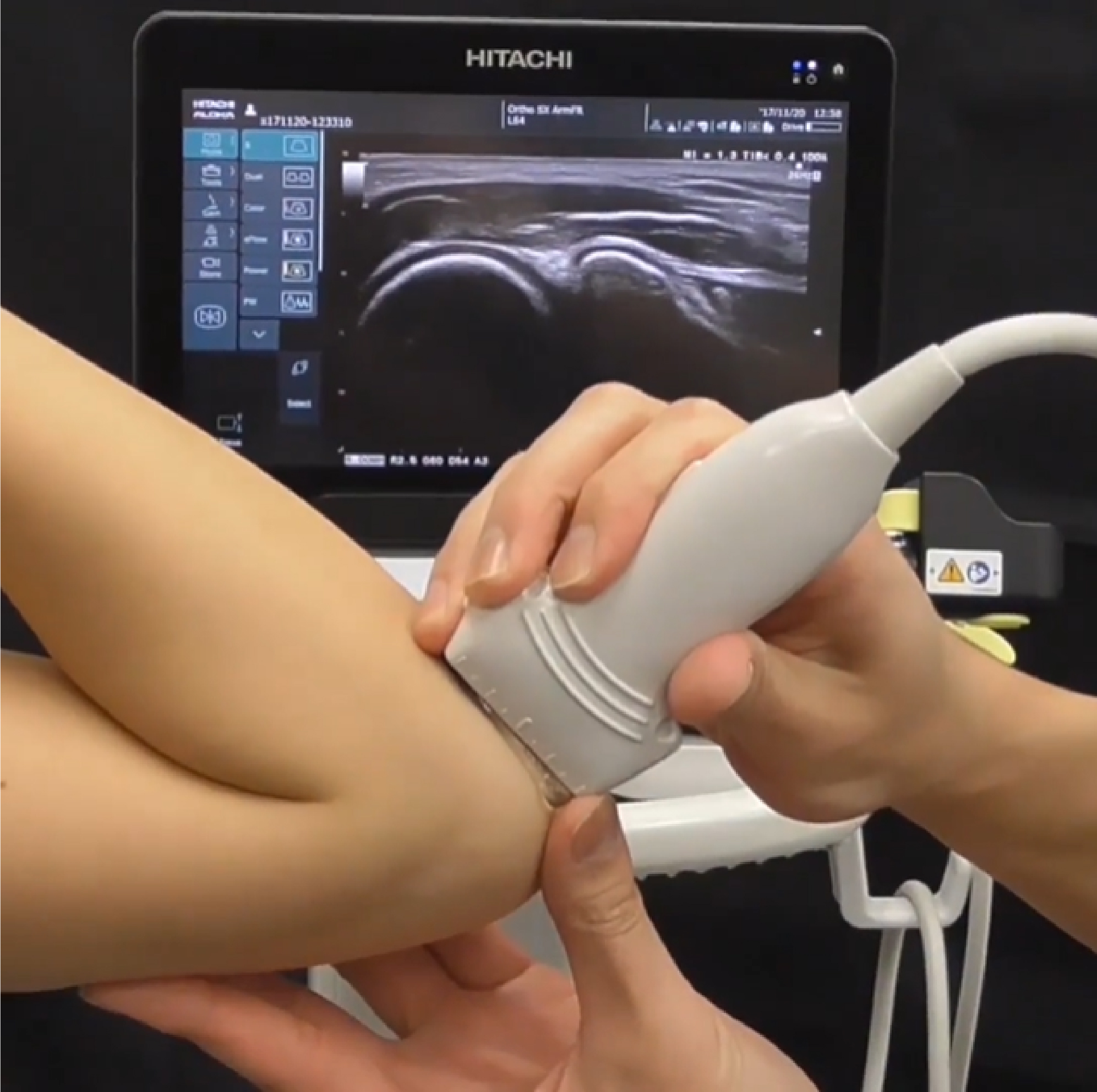 運動器エコー診療・超音波画像診断機器普及への取り組み | 日本シグ