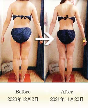 難波店・H2様の痩身エステビフォーアフター体験談｜オリエンタル