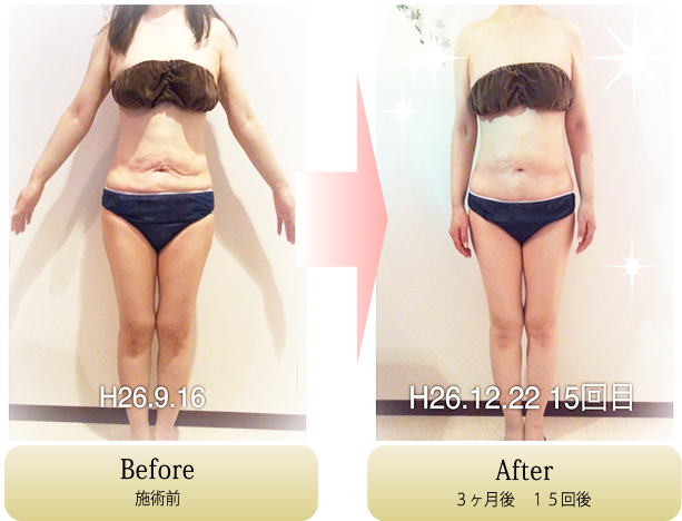 ダイエットを水戸でお探しなら痩身メニュー豊富なサクスィードへ