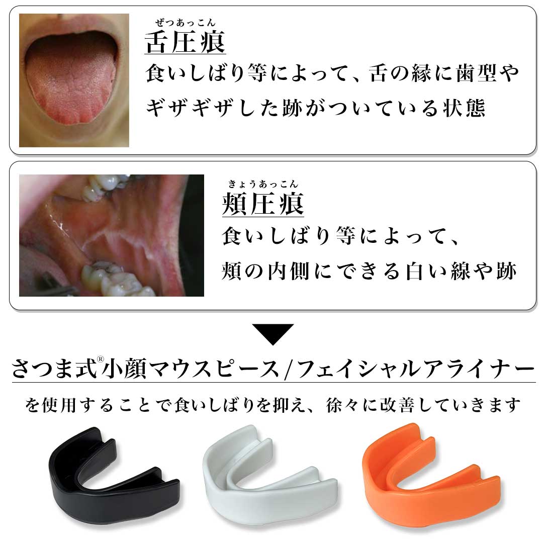 さつま式小顔マウスピース Facial Aligners【3種セット】 - SUGARCRANZ