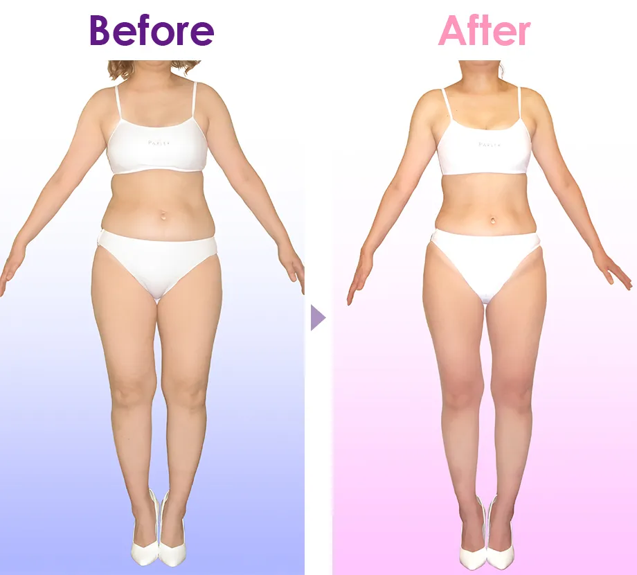 ラ・パルレ エステの口コミ・体験談｜脚やせ・痩身・ブライダル