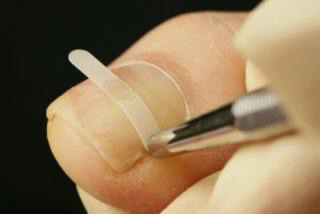 Private Room pinkrose nail＆eyelash｜足の巻き爪ケア｜B/Sブレイス