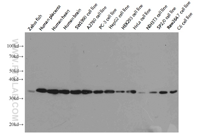 GAPDH antibody (60004-1-Ig) | Proteintech | 武汉三鹰生物技术有限公司