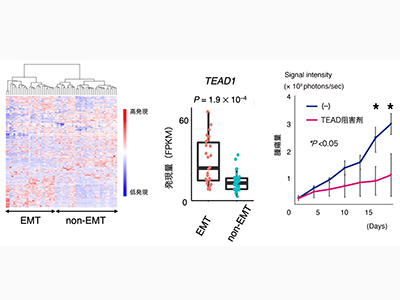 スキルス胃がんの治療標的を腹水細胞の全ゲノム解析により同定－国がん