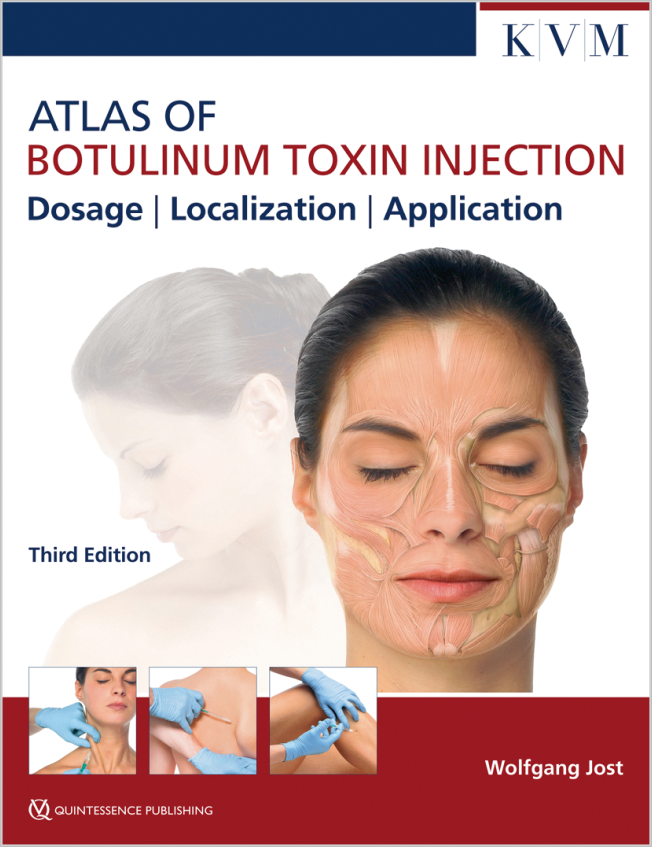 Atlas of Botulinum Toxin Injection | Wolfgang Jost | Quintessence