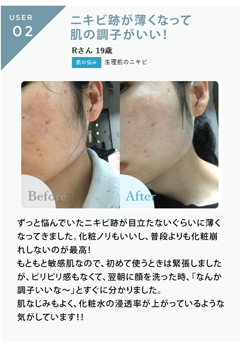 正規販売店】redeal. リディアル RDセラム 30ml 美容液 アクネ