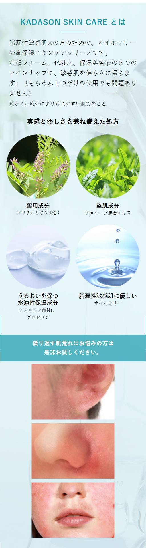 楽天市場】【公式】カダソン薬用洗顔フォーム／脂漏肌の赤み、かゆみに