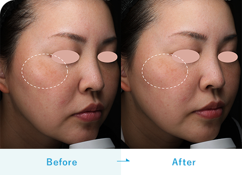 TXA濃縮美容液（ダームエデン）｜内服・外用薬・その他商品なら湘南