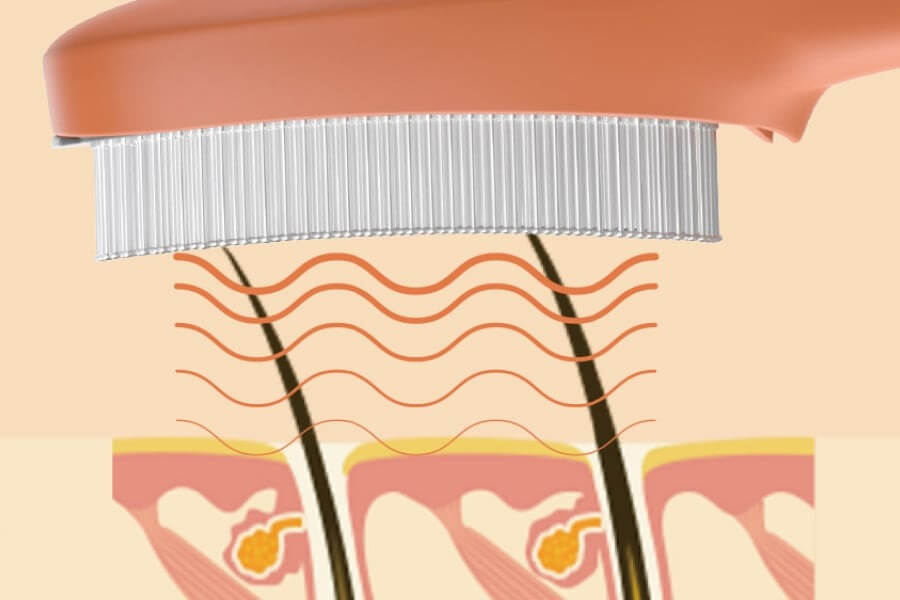 スカルプケア美髪ブラシ｜頭皮ケア・美髪ケア・EMS・光美容を1台で