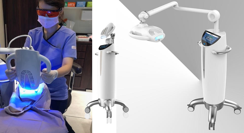 ホームホワイトニング 前歯を白くする