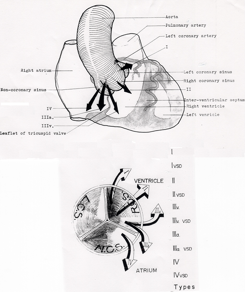 心臓外科の父と天才外科医 榊原仟と今野草二】文京区,内科,本郷,循環器