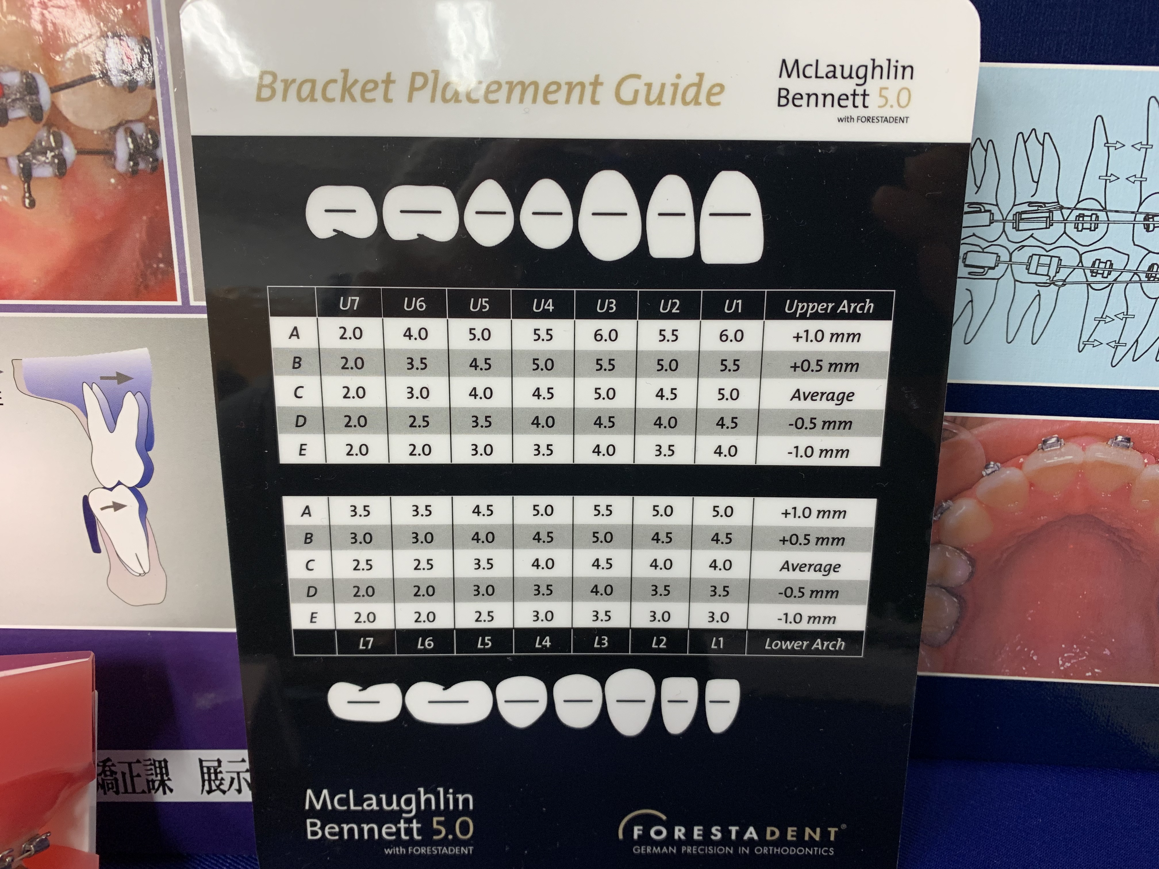 ストレートワイヤーエッジワイズシステムの臨床 | ブログ | 羽村市
