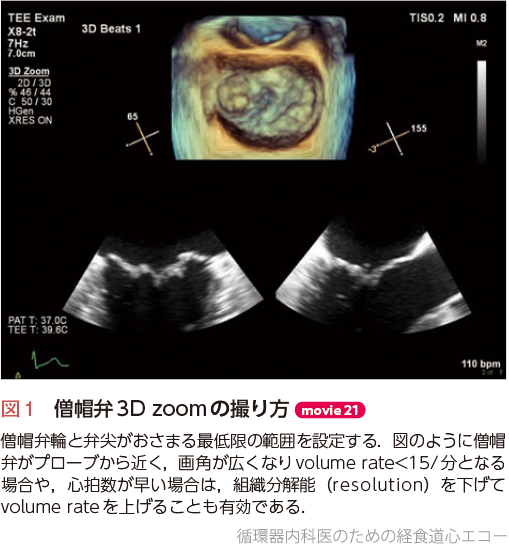 循環器内科医のための経食道心エコー〜基本的な手技から術中・術前の